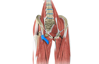 Advances in Anterior Hip Replacement