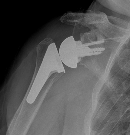 x-ray