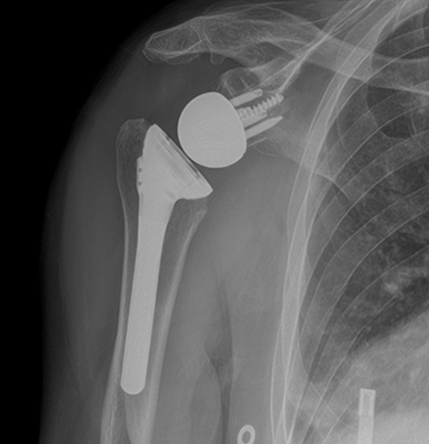x-ray
