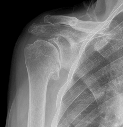 x-ray