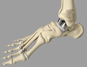 foot & ankle bones