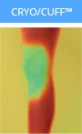 temperature image