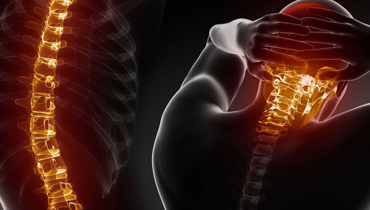digital imaging of spine