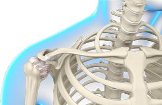 7 Joint Conditions Commonly Associated with Diabetes