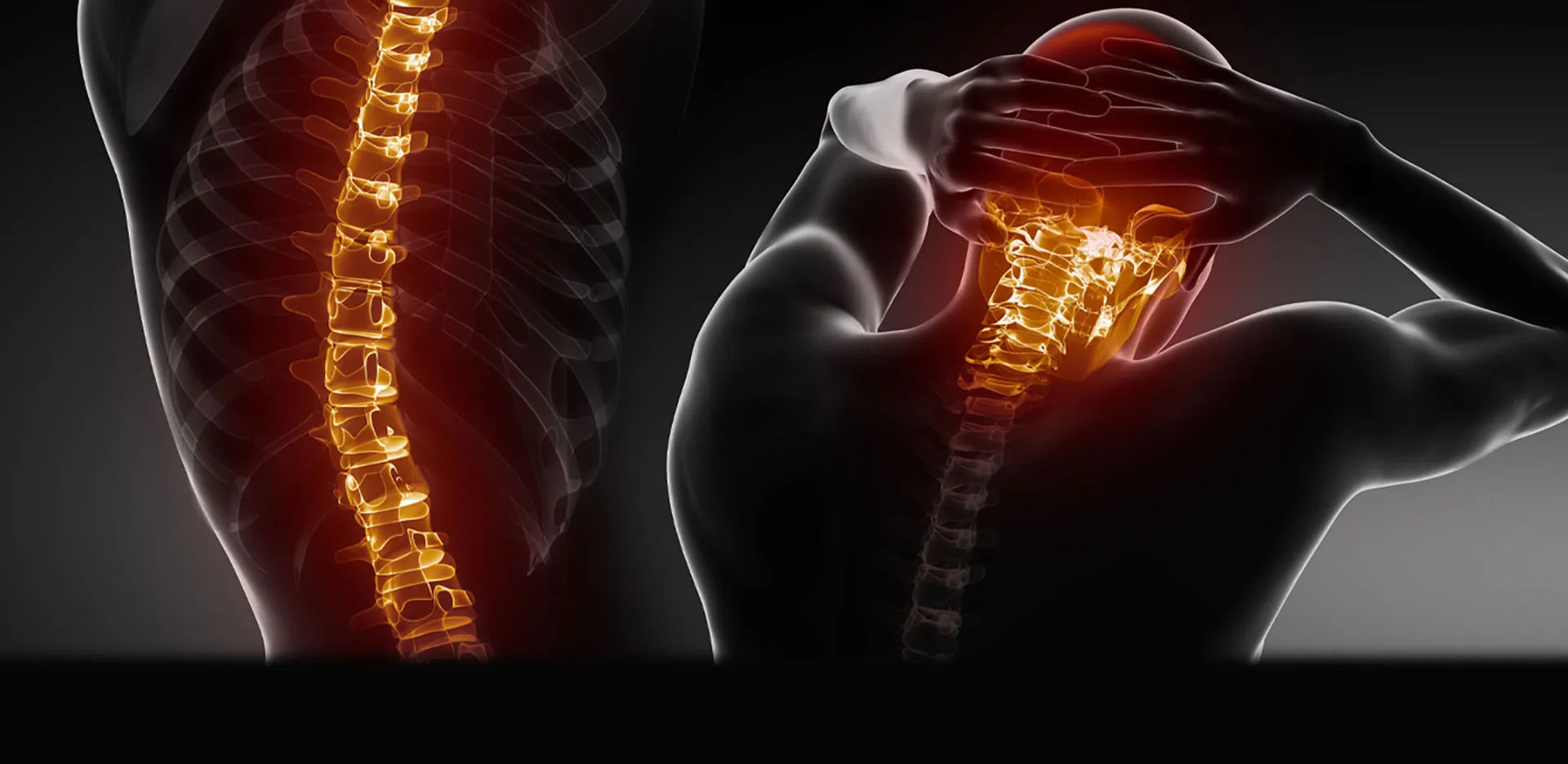 spine xray graphics